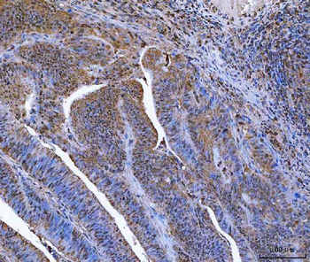 Glutathione Reductase/GSR Rabbit Polyclonal Antibody