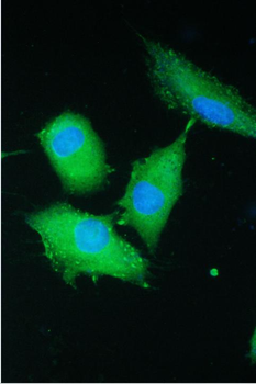 PARN Rabbit Polyclonal Antibody