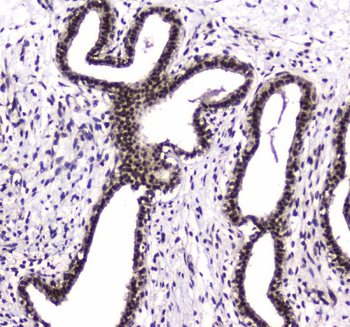 PARN Rabbit Polyclonal Antibody