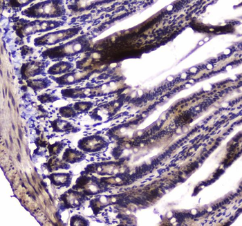 PARN Rabbit Polyclonal Antibody
