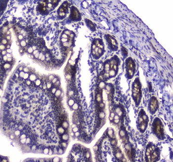 PARN Rabbit Polyclonal Antibody