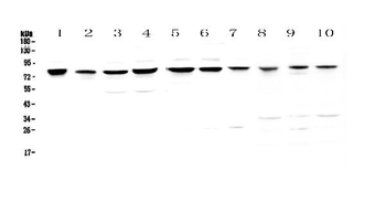 PARN Rabbit Polyclonal Antibody
