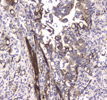 MAP1LC3A Rabbit Polyclonal Antibody