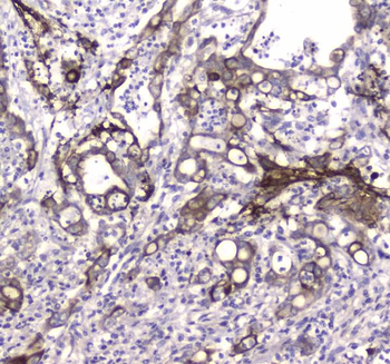 MAP1LC3A Rabbit Polyclonal Antibody