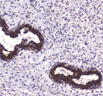 MAP1LC3A Rabbit Polyclonal Antibody