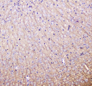MAP1LC3A Rabbit Polyclonal Antibody
