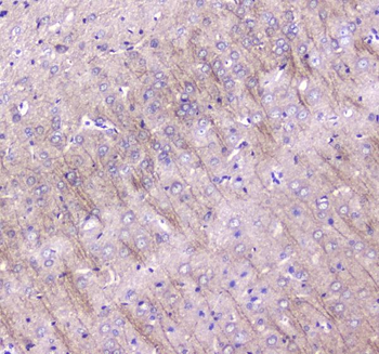 MAP1LC3A Rabbit Polyclonal Antibody