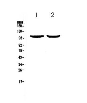Dynamin 2/DNM2 Rabbit Polyclonal Antibody
