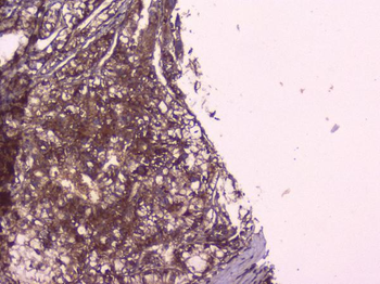 PBP/PEBP1 Rabbit Polyclonal Antibody