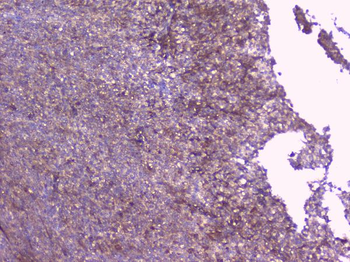 PBP/PEBP1 Rabbit Polyclonal Antibody