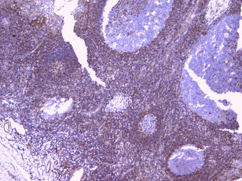 PBP/PEBP1 Rabbit Polyclonal Antibody