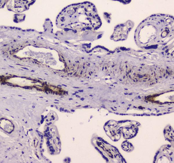 Myosin light chain kinase/MYLK Rabbit Polyclonal Antibody