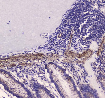 Myosin light chain kinase/MYLK Rabbit Polyclonal Antibody