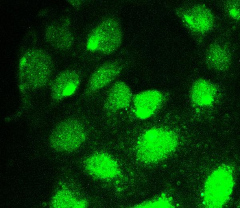RUNX1T1/ETO Rabbit Polyclonal Antibody