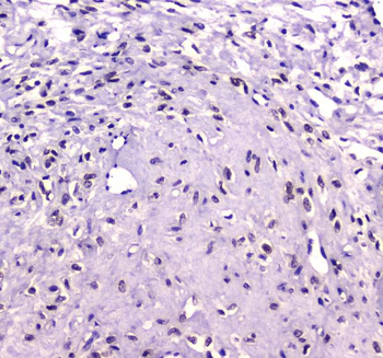 RUNX1T1/ETO Rabbit Polyclonal Antibody