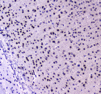 RUNX1T1/ETO Rabbit Polyclonal Antibody