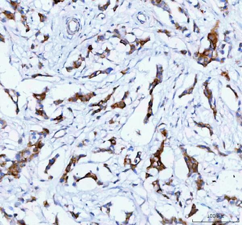 TACI/TNFRSF13B Rabbit Polyclonal Antibody
