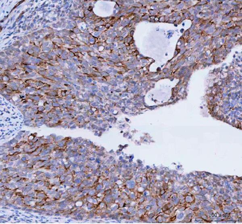 TACI/TNFRSF13B Rabbit Polyclonal Antibody