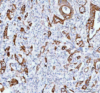 TACI/TNFRSF13B Rabbit Polyclonal Antibody