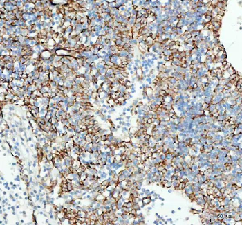 TACI/TNFRSF13B Rabbit Polyclonal Antibody