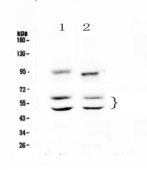 CaMKII alpha/CAMK2A Rabbit Polyclonal Antibody