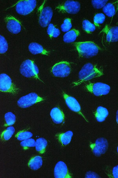 TCP1 eta/CCT7 Rabbit Polyclonal Antibody