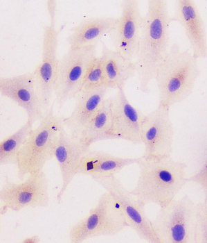 beta Catenin CTNNB1 Mouse Monoclonal Antibody