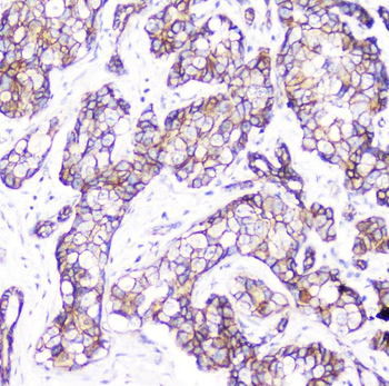 beta Catenin CTNNB1 Mouse Monoclonal Antibody