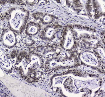 APE1 APEX1 Mouse Monoclonal Antibody