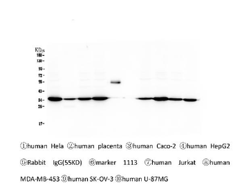 Emerin EMD Mouse Monoclonal Antibody