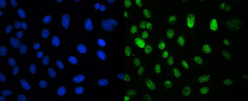 CRM1 XPO1 Mouse Monoclonal Antibody