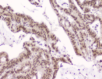 CRM1 XPO1 Mouse Monoclonal Antibody