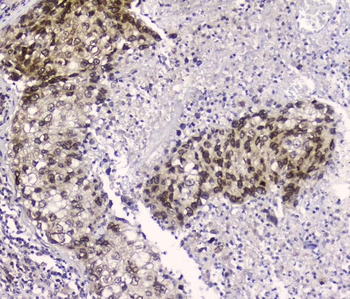 CRM1 XPO1 Mouse Monoclonal Antibody