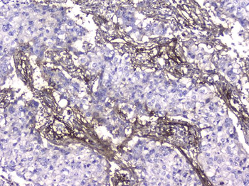 Collagen IV COL4A1 Mouse Monoclonal Antibody