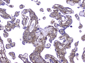 Collagen IV COL4A1 Mouse Monoclonal Antibody