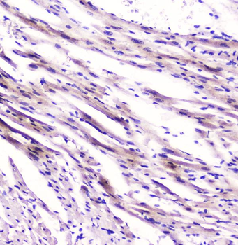 Cardiac FABP Fabp3 Mouse Monoclonal Antibody