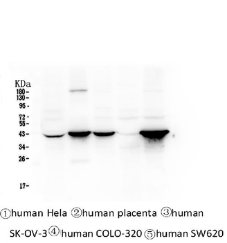 Cytokeratin 19 KRT19 Mouse Monoclonal Antibody