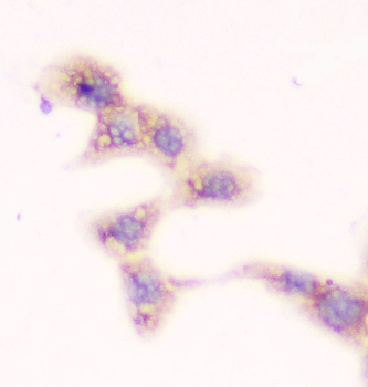 SMN1/2 Mouse Monoclonal Antibody