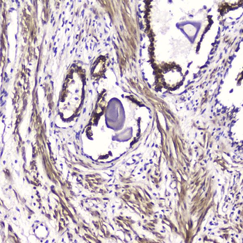 ATF4 Rabbit Polyclonal Antibody