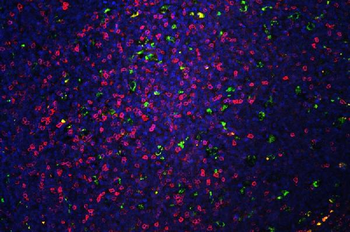 CD5 Rabbit Polyclonal Antibody