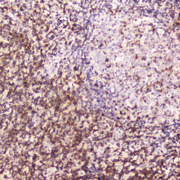 CD5 Rabbit Polyclonal Antibody