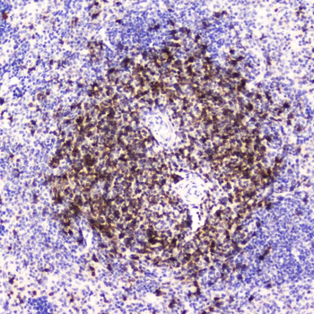 CD5 Rabbit Polyclonal Antibody