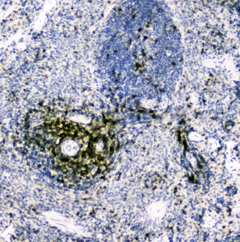 CD5 Rabbit Polyclonal Antibody