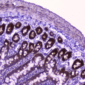 FLIP/CFLAR Rabbit Polyclonal Antibody
