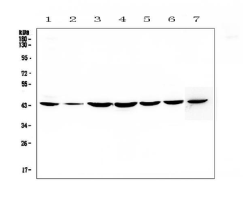 FLIP/CFLAR Rabbit Polyclonal Antibody