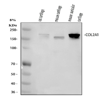 Collagen II/COL2A1 Rabbit Polyclonal Antibody