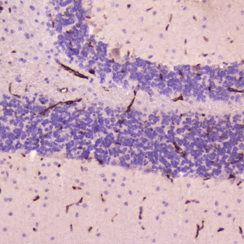 C Reactive Protein/Crp Rabbit Polyclonal Antibody