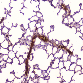 C Reactive Protein/Crp Rabbit Polyclonal Antibody
