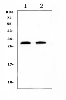C Reactive Protein/Crp Rabbit Polyclonal Antibody