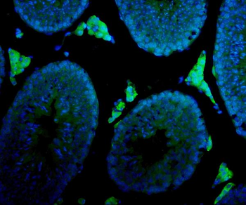Cytochrome P450 17A1/Cyp17a1 Rabbit Polyclonal Antibody